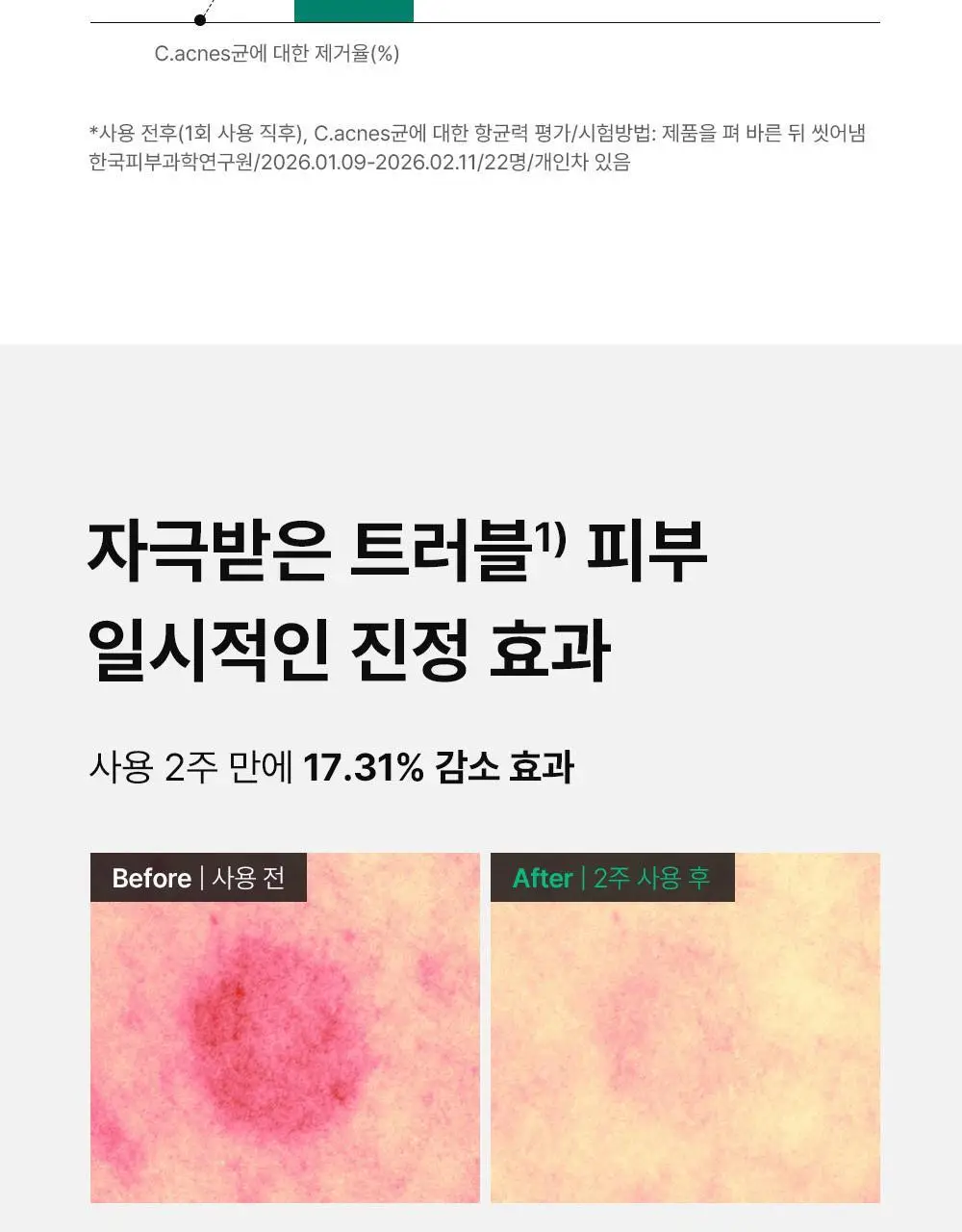 [여드름기능성] 동아제약 아크네 프로 겔제 30ml 상세페이지 10